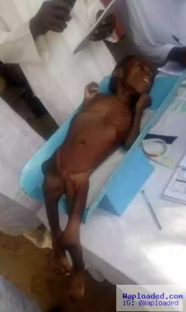 Heartbreaking photos of a starving and malnourished 2-year-old child from Gombe State